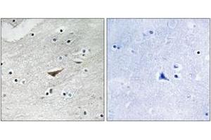 Immunohistochemistry analysis of paraffin-embedded human brain, using VE-Cadherin (Phospho-Tyr731) Antibody. (Cadherin 5 Antikörper  (pTyr731))