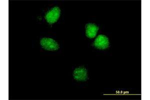 Immunofluorescence of monoclonal antibody to HOXA5 on HeLa cell. (HOXA5 Antikörper  (AA 171-270))