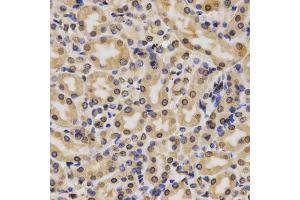 Immunohistochemistry of paraffin-embedded rat kidney using MonoMethyl-Histone H3-K4 antibody (ABIN1872994) at dilution of 1:200 (40x lens). (Histone 3 Antikörper  (H3K4me))