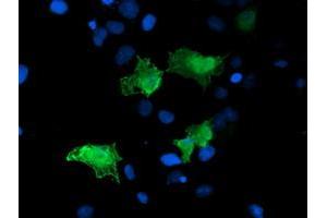 Image no. 1 for anti-Low Density Lipoprotein Receptor Adaptor Protein 1 (LDLRAP1) antibody (ABIN1496685) (LDLRAP1 Antikörper)