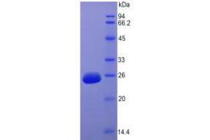 SDS-PAGE analysis of Rat FGF15 Protein. (FGF15 Protein)