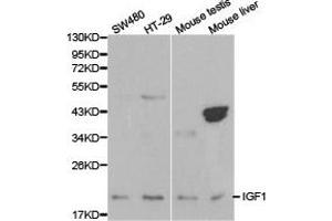 Western Blotting (WB) image for anti-Insulin-Like Growth Factor 1 (IGF1) antibody (ABIN1873156) (IGF1 Antikörper)