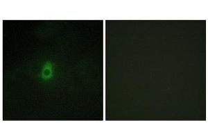 Immunofluorescence (IF) image for anti-Cytochrome P450, Family 2, Subfamily E, Polypeptide 1 (CYP2E1) (C-Term) antibody (ABIN1850358)
