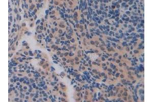 Immunohistochemistry (IHC) image for anti-Cadherin-16 (CDH16) (AA 353-617) antibody (ABIN7441937)