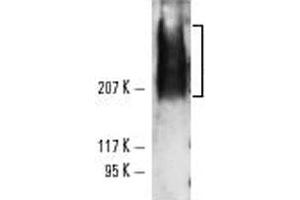 Western blot analysis of TRA-1-81 expression using TRA-1-81 monoclonal antibody, clone TRA-1-81  in NTERA-2 cl. (TRA1-81 Antikörper)