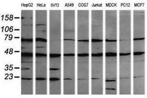 Image no. 1 for anti-Mitogen-Activated Protein Kinase Kinase 1 (MAP2K1) antibody (ABIN1499374)
