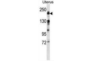 Western Blotting (WB) image for anti-Mitogen-Activated Protein Kinase Kinase Kinase 4 (MAP3K4) (AA 1065-1097), (Middle Region) antibody (ABIN953298)