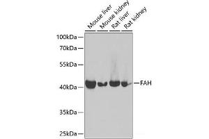 Western blot analysis of extracts of various cell lines using FAH Polyclonal Antibody at dilution of 1:1000. (FAH Antikörper)