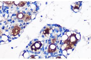 Immunohistochemistry of paraffin-embedded Rat fat using UCP1 Polyclonal Antibody at dilution of 1:100 (40x lens). (UCP1 Antikörper)