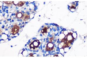 Immunohistochemistry of paraffin-embedded Rat fat using UCP1 Polyclonal Antibody at dilution of 1:100 (40x lens).