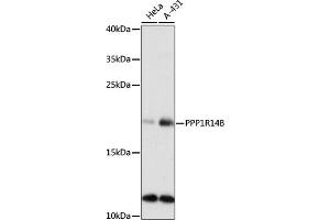 Western blot analysis of extracts of various cell lines, using PPP1R14B antibody (ABIN7269675) at 1:1000 dilution. (PPP1R14B Antikörper  (AA 68-147))