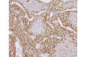 IHC analysis of CYP2E1 using anti-CYP2E1 antibody (ABIN7601446).