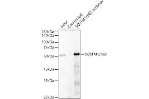 Immunoprecipitation analysis of 300 μg extracts of 293T cells using 3 μg SQSTM1/p62 antibody (ABIN7270205). (SQSTM1 Antikörper)
