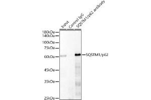 Immunoprecipitation analysis of 300 μg extracts of 293T cells using 3 μg SQSTM1/p62 antibody (ABIN7270205).