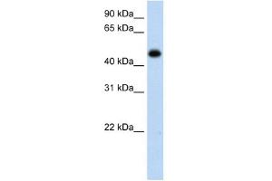 HAO1 antibody used at 1 ug/ml to detect target protein. (HAO1 Antikörper)