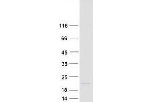 Validation with Western Blot (REG3A Protein (Transcript Variant 3) (Myc-DYKDDDDK Tag))