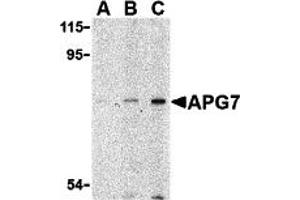 Western Blotting (WB) image for anti-ATG7 Autophagy Related 7 (ATG7) (N-Term) antibody (ABIN1031233) (ATG7 Antikörper  (N-Term))