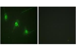 Immunofluorescence analysis of NIH-3T3 cells, using MSK1 (Phospho-Ser360) Antibody. (MSK1 Antikörper  (pSer360))