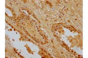 Immunohistochemistry (IHC) image for anti-Heat Shock 70kDa Protein 8 (HSPA8) (AA 2-646) antibody (ABIN7154883)