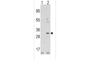Western blot analysis of NNMT using rabbit polyclonal NNMT Antibody using 293 cell lysates (2 ug/lane) either nontransfected (Lane 1) or transiently transfected with the NNMT gene (Lane 2). (NNMT Antikörper  (AA 77-106))