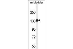 Western blot analysis in mouse bladder tissue lysates (35ug/lane). (TDRD7 Antikörper  (C-Term))