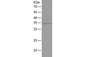 Western Blotting (WB) image for Uridine Phosphorylase 1 (UPP1) (AA 1-310) protein (His tag) (ABIN7287385) (UPP1 Protein (AA 1-310) (His tag))