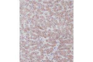 Immunohistochemical analysis of C on paraffin-embedded Human liver tissue. (UGT2B15 Antikörper  (AA 156-185))