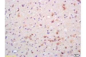 Formalin-fixed and paraffin embedded rat brain labeled with Rabbit Anti Phospho-NMDAR2B (Tyr1336) Polyclonal Antibody, Unconjugated (ABIN801228) at 1:200 followed by conjugation to the secondary antibody and DAB staining (GRIN2B Antikörper  (pTyr1336))