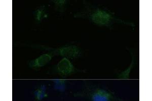 Immunofluorescence analysis of U-251 MG cells using VHL Polyclonal Antibody at dilution of 1:100 (40x lens). (VHL Antikörper)
