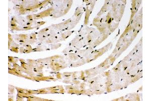 Anti- SIRT6Picoband antibody, IHC(P) IHC(P): Mouse Cardiac Muscle Tissue (SIRT6 Antikörper  (AA 14-180))