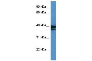 WB Suggested Anti-HNRPAB  Antibody Titration: 0. (HNRNPAB Antikörper  (C-Term))