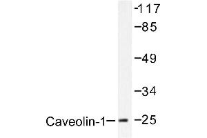 Image no. 1 for anti-Caveolin 1, Caveolae Protein, 22kDa (CAV1) antibody (ABIN265339) (Caveolin-1 Antikörper)