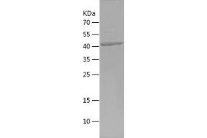 Western Blotting (WB) image for Nuclear RNA Export Factor 1 (NXF1) (AA 426-619) protein (His-IF2DI Tag) (ABIN7124215) (NXF1 Protein (AA 426-619) (His-IF2DI Tag))