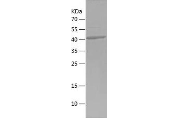 NXF1 Protein (AA 426-619) (His-IF2DI Tag)