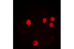 Immunofluorescent analysis of Histone H2B (AcK12) staining in HeLa cells. (Histone H2B Antikörper  (acLys12, N-Term))