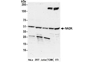 anti-NAD Kinase (NADK) (AA 25-75) antibody