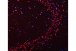 IF analysis of SNRPN using anti-SNRPN antibody (ABIN3043934). (SNRPN Antikörper  (N-Term))