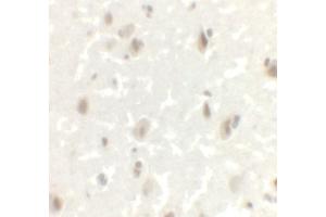 Immunohistochemistry (IHC) image for anti-LIM Homeobox Transcription Factor 1, alpha (LMX1A) (C-Term) antibody (ABIN1077395)