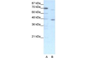 Western Blotting (WB) image for anti-Estrogen Receptor 2 (ESR2) antibody (ABIN2460264) (ESR2 Antikörper)