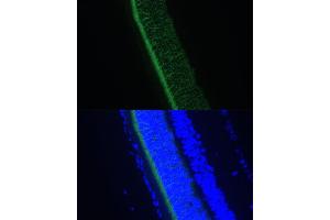 Immunofluorescence analysis of rat eye using GNGT1 Polyclonal Antibody (ABIN7267288) at dilution of 1:100 (40x lens).