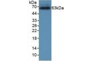 Detection of Recombinant CRHBP, Rat using Monoclonal Antibody to Corticotropin Releasing Hormone Binding Protein (CRHBP) (CRHBP Antikörper  (AA 25-322))