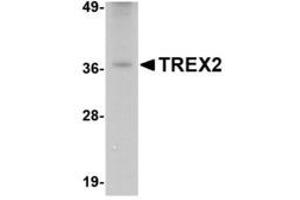 Image no. 1 for anti-three Prime Repair Exonuclease 2 (Trex2) (C-Term) antibody (ABIN341719) (TREX2 Antikörper  (C-Term))