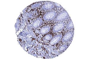 Intense CD56 immunostaining of nerve fibres in the appendix mucosa (Rekombinanter CD56 Antikörper)