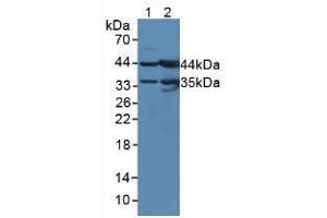 Figure. (UPB1 Antikörper  (AA 121-384))