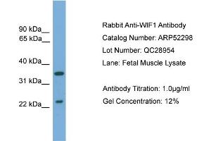 WB Suggested Anti-WIF1  Antibody Titration: 0. (WIF1 Antikörper  (N-Term))