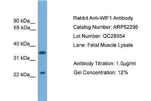 WB Suggested Anti-WIF1  Antibody Titration: 0. (WIF1 Antikörper  (N-Term))