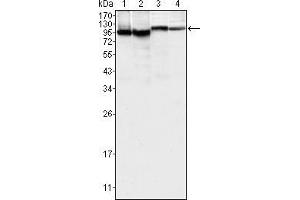 Western blot analysis using BTK mouse mAb against K562 (1), MCF-7 (2), Jurkat (3) and HEK293 (4) cell lysate. (BTK Antikörper)