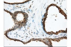 Immunohistochemical staining of paraffin-embedded Human Kidney tissue using anti-ACAT2 mouse monoclonal antibody. (ACAT2 Antikörper)