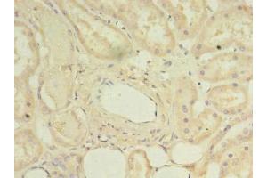 Immunohistochemistry of paraffin-embedded human kidney tissue using ABIN7150796 at dilution of 1:100 (DYRK4 Antikörper  (AA 201-520))