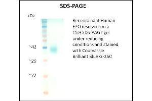 SDS-PAGE (SDS) image for Erythropoietin (EPO) (Active) protein (ABIN5509957)